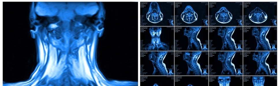 Rekomendacje PTO, PTS, PLTR dotyczące badania MRI u pacjenta ortodontycznego
