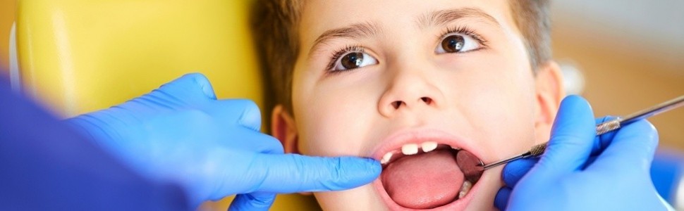 Kiedy usuwać zęby mleczne ze wskazań ortodontycznych?