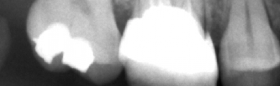 Rodzaje zdjęć wewnątrzustnych wykorzystywanych w stomatologii