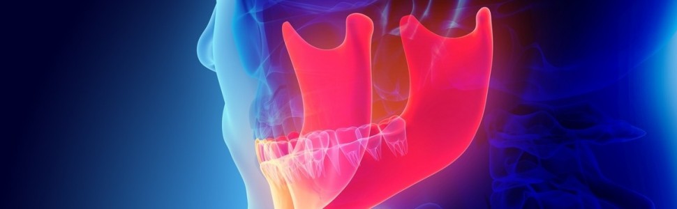 Przepchnięcie materiału do kanału żuchwy