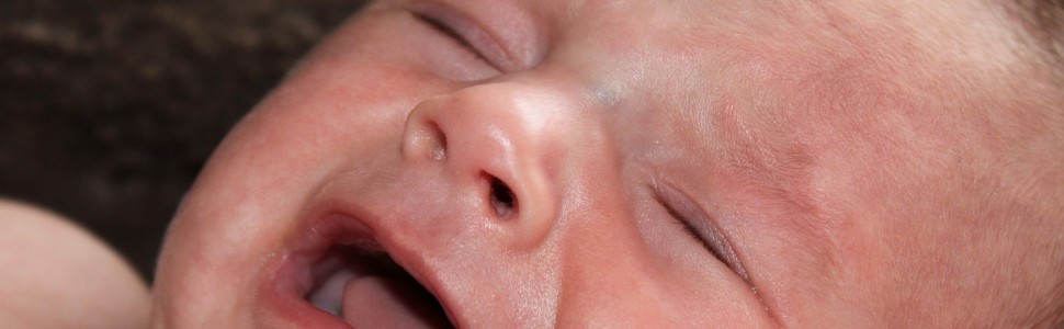 Powikłania skórne tocznia rumieniowatego noworodków
