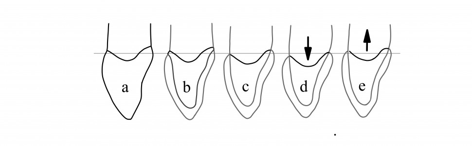 SPECJALISTA RADZI: Preparacja bezstopniowa