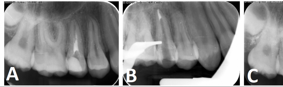 SPECJALISTA RADZI: Materiały bioceramiczne (...)