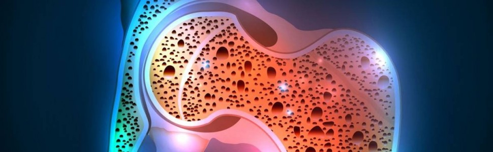 SPECJALISTA RADZI: Osteoporoza a choroby przyzębia