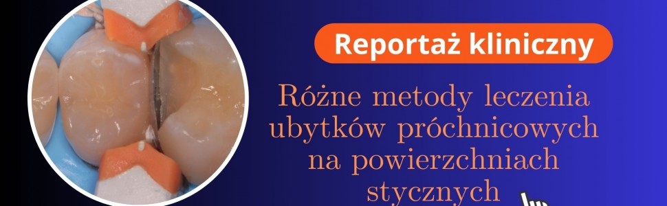 PRZECZYTAJ ARTYKUŁ W WOLNYM DOSTĘPIE