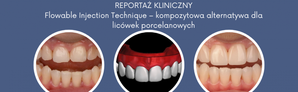 PRZECZYTAJ ARTYKUŁ W WOLNYM DOSTĘPIE