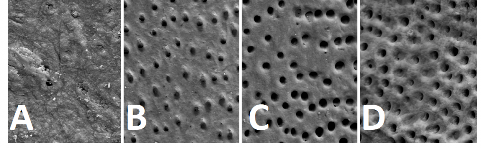 SPECJALISTA RADZI: Preparaty złożone do usuwania warstwy mazistej