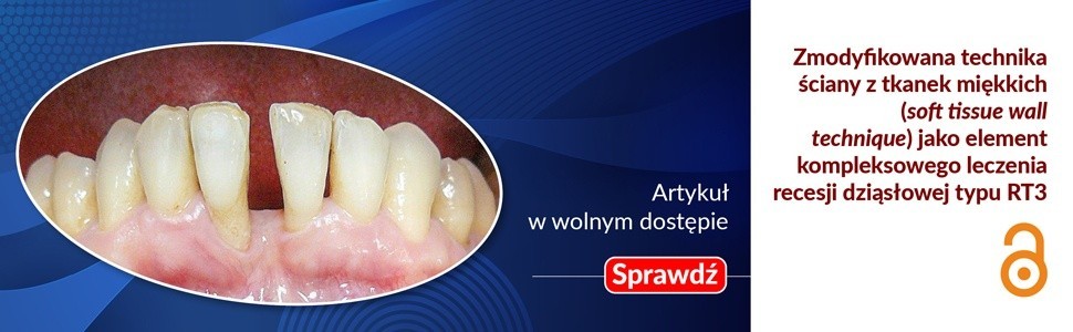 Przeczytaj artykuł w wolnym dostępie