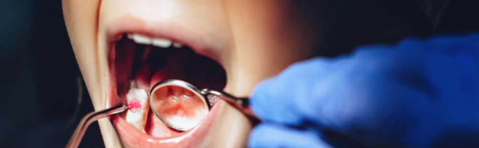 Pacjent z zespołem Ehlersa-Danlosa w gabinecie stomatologicznym