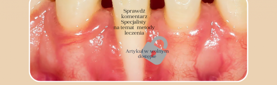 Streszczenie artykułu i komentarz Specjalisty