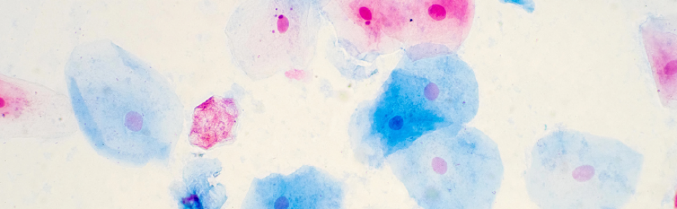 SPECJALISTA RADZI. Zakażenie HPV w jamie ustnej 