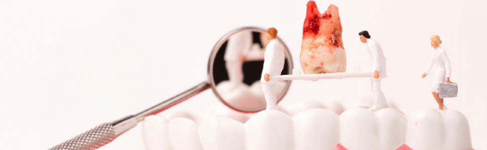 Przewlekła przetoka podbródkowa pochodzenia zębowego początkowo błędnie zdiagnozowana jako nieodzębowa zmiana patologiczna - opis przypadku