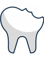 Czy stosując uniwersalne systemy łączące, należy wytrawiać szkliwo?