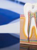 Czas uformowania się wierzchołka korzenia podczas apeksyfikacji wodorotlenkiem wapnia