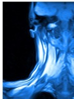 Rekomendacje PTO, PTS, PLTR dotyczące badania MRI u pacjenta ortodontycznego