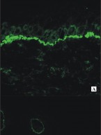 Zaawansowane techniki obrazowe w dermatologii