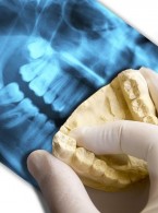 Czy to prawda, że mają ulec zmianie przepisy w dziedzinie ochrony radiologicznej dotyczące lekarzy stomatologów?