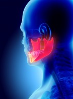 Przepchnięcie materiału do kanału żuchwy