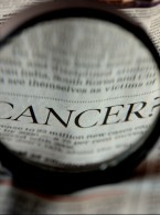 Ryzyko wtórnych nowotworów u pacjentów z ziarniniakiem grzybiastym