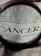 Skóra głowy miejscem wysokiego ryzyka wystąpienia przerzutów raka kolczystokomórkowego