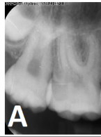 SPECJALISTA RADZI: Materiały bioceramiczne (...)