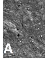 SPECJALISTA RADZI: Preparaty złożone do usuwania warstwy mazistej