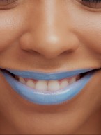 SPECJALISTA RADZI: Czerniak błony śluzowej jamy ustnej