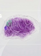 SPECJALISTA RADZI: Pacjent z padaczką na fotelu dentystycznym