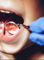 Pacjent z zespołem Ehlersa-Danlosa w gabinecie stomatologicznym