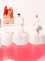 Przewlekła przetoka podbródkowa pochodzenia zębowego początkowo błędnie zdiagnozowana jako nieodzębowa zmiana patologiczna - opis przypadku